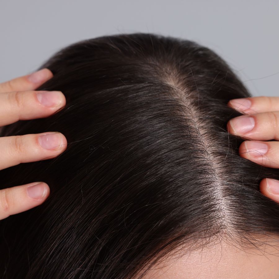 Scalp Health 101: Why It Matters for Beautiful&nbsp;Hair